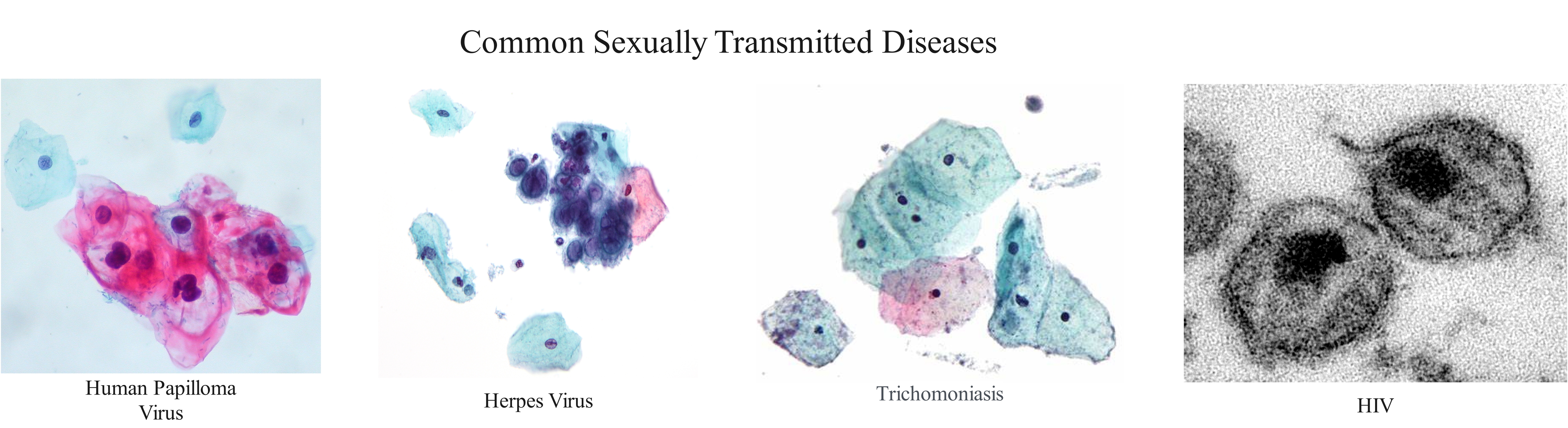 Common STDS