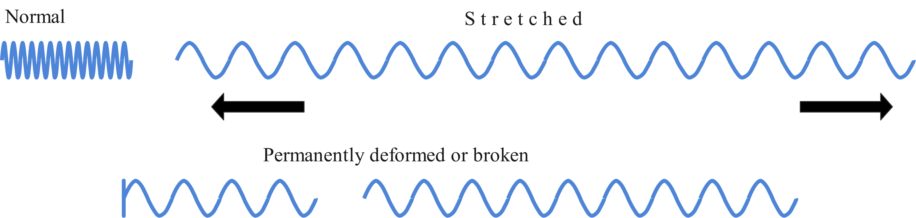 Elastic limit